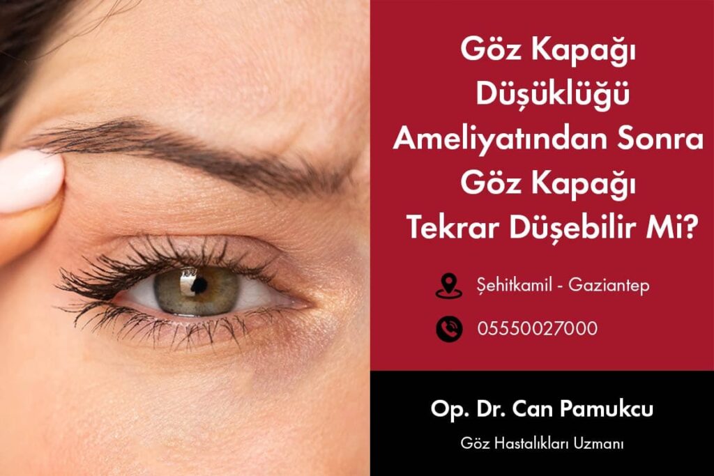 Göz Kapağı Düşüklüğü Ameliyat Sonrası Göz Kapağı Düşüklüğü