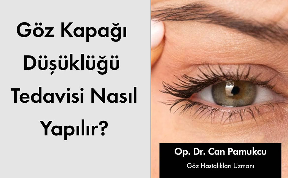 Göz Kapağı Düşüklüğü Tedavisi Nasıl Yapılır?