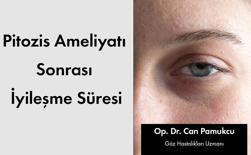 Pitozis Ameliyatı Sonrası İyileşme Süresi