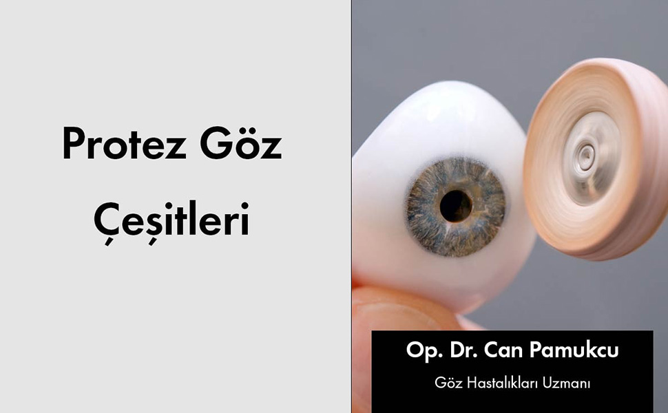 Protez Göz Çeşitleri