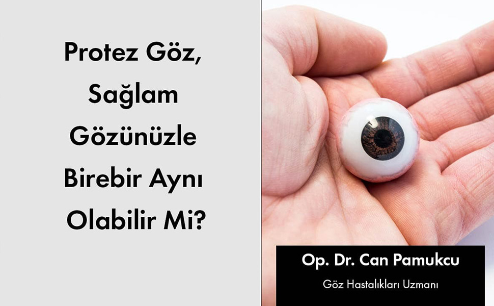 Protez Göz Sağlam Gözünüzle Birebir Aynı Olabilir Mi?