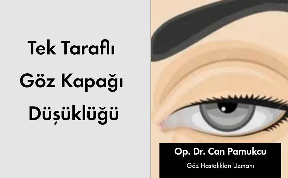 Tek Taraflı Göz Kapağı Düşüklüğü